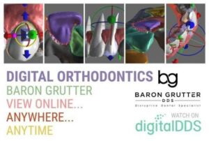 Digital Orthodontics Online Course (Clear Aligners)
