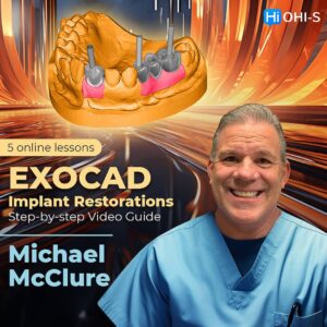 EXOCAD Implant Restorations – Step-by-step Video Guide 2023
