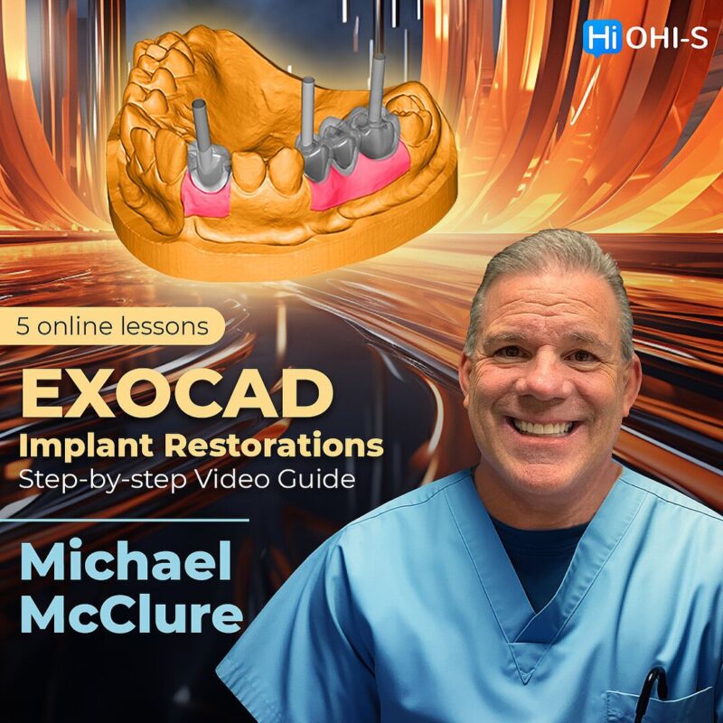 EXOCAD Implant Restorations – Step-by-step Video Guide 2023