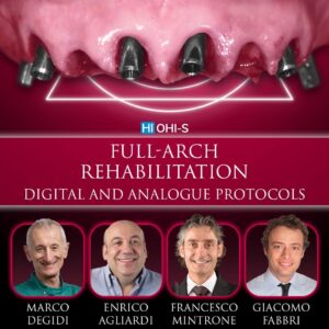 Full-arch rehabilitation: digital and analogue Protocols