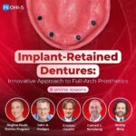 Implant-Retained Dentures Innovative Approach to Full-Arch Prosthetics