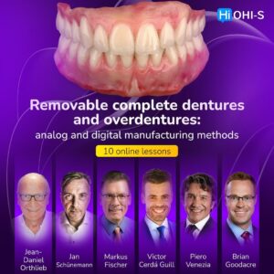 Removable complete dentures and overdentures