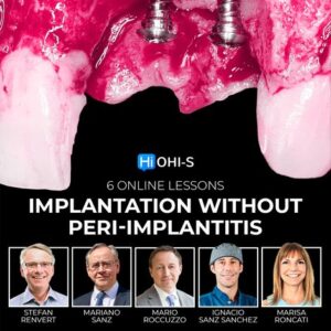 OHI-S Implantation Without Peri-Implantitis