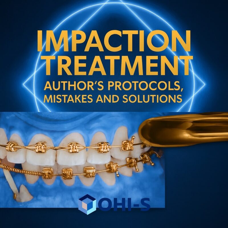 OHI-S Impaction Treatment Author’s Protocols, Mistakes and Solutions
