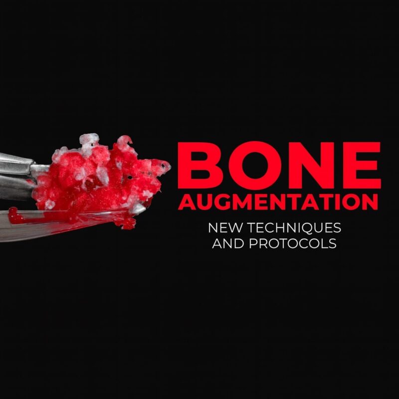 OHI-S Bone Augmentation 2.0, New Techniques and Protocols