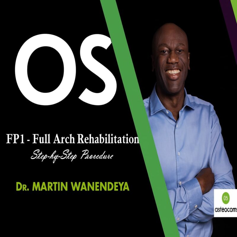 Osteocom FP1 – Full Arch Rehabilitation Step-by-Step Procedure
