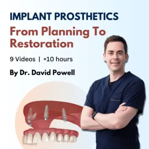 Osteocom Implant Prosthetics from Planning to Restoration