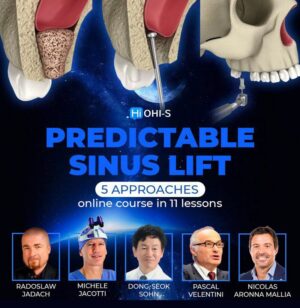 OHI-S Predictable Sinus Lift