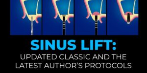 OHI-S Sinus Lift Updated Classic and the Latest Author’s Protocols