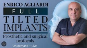 Osteocom Full tilted implants Prosthetic and Surgical protocols