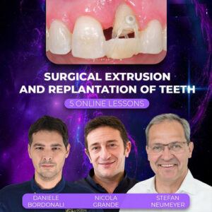 OHI-S Surgical Extrusion and Replantation of Teeth