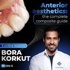OHI-S Anterior Aesthetics The Complete Composite Guide
